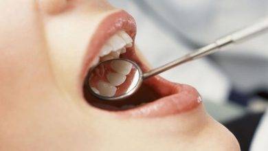Common Dental Problems and How to Prevent Them 1