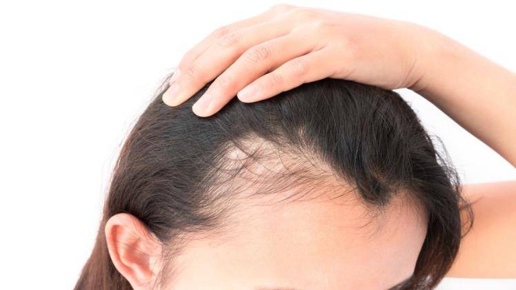 Benefits Of Prp Hair Restoration