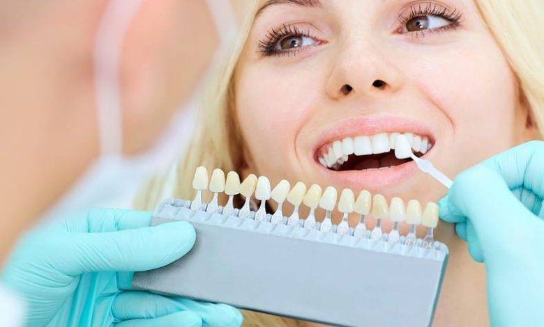 Why You Should Get Your Teeth Whitened By A Dentist