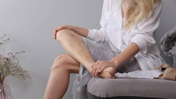 Heres Why You Should Consider Sclerotherapy in Glen Rock